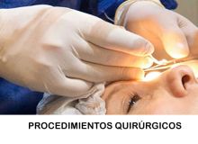 Procedimientos Quirúrgicos